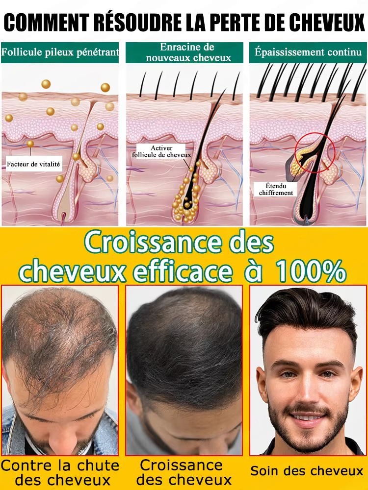 순한 식물 성분이 두피를 케어하고, 두껍고 자연스러운  - Hair Care Natural Ingredients 리뷰 및 가격